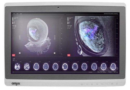 Onyx-Zeus-248 Professional Medical AIO i7-7600U/8GB/250GB SSD *TouchScreen* *No Stand*
